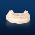 Dental Zirconia Porcelain Veneer
